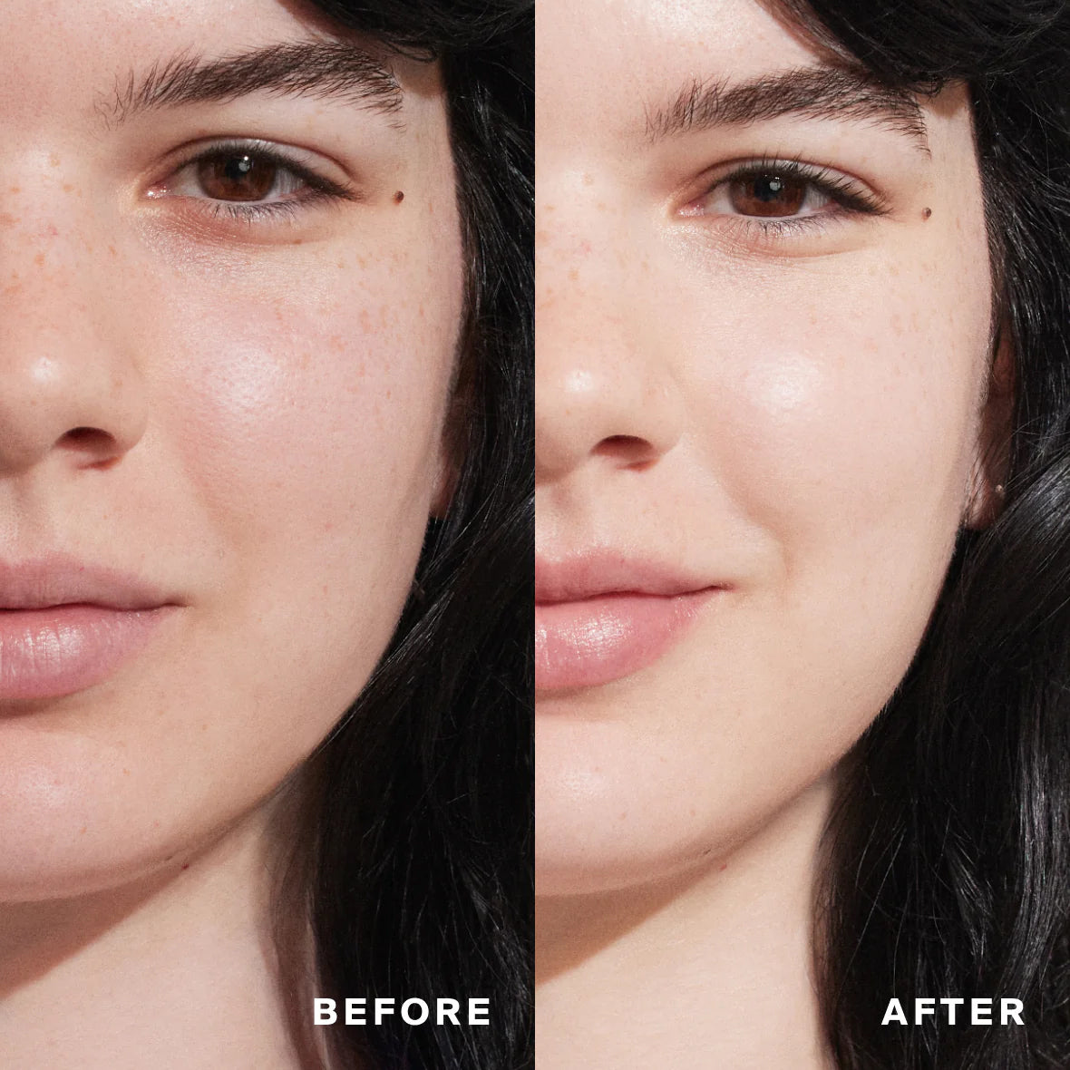 Before and after comparison of a person's face with visible skin improvement.
