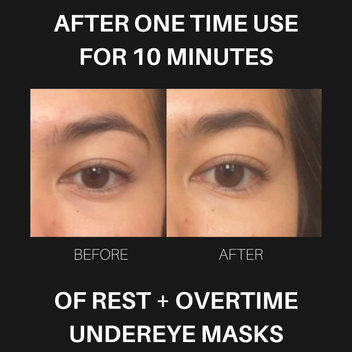 Before and after effect of rest + overtime undereye masks on a person's eyes.