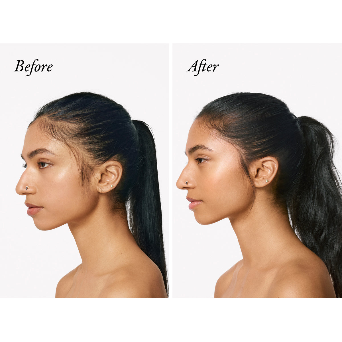 Before and after using Oribe Serene Scalp products. 