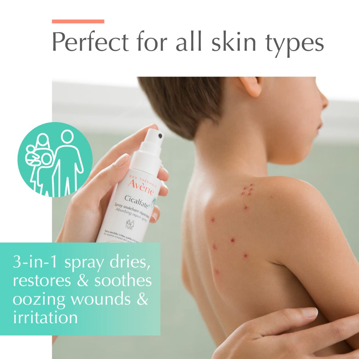 Child with skin irritation using A bottle of Avene Cicalfate+ Soothing Spray