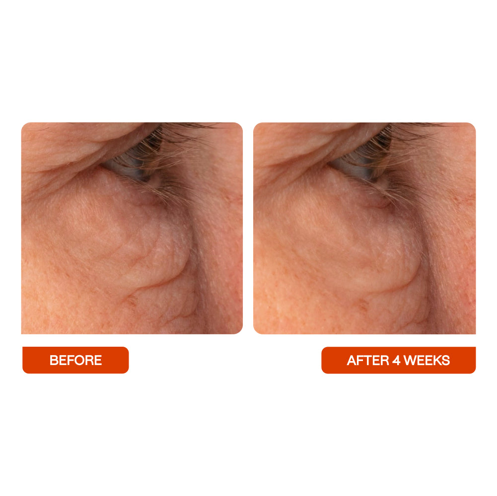 Closeup of a persons eye before and after 4 weeks of using BeautyStat's Universal C Eye Perfector