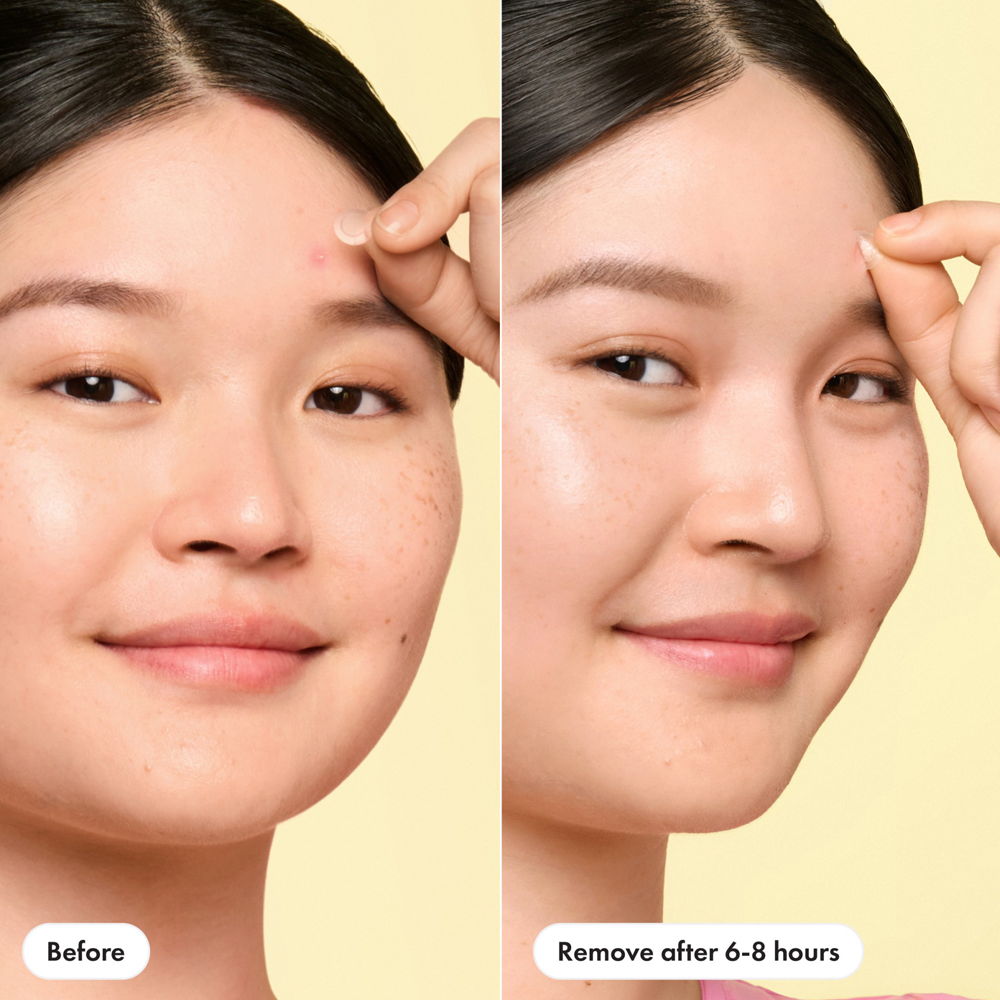 Before and after comparison of a person's face with a yellow background