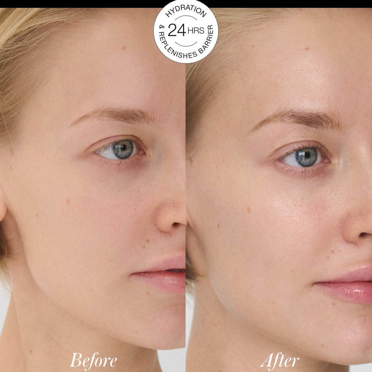 Closeup of a woman's face before and 24 hours after using RMS Kakadu Luxe Cream. Before image is on the left, after image is on the right.