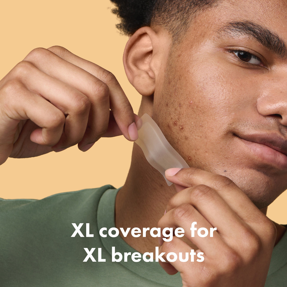 Person using a skincare tool on their face with text 'XL coverage for XL breakouts' on a beige background