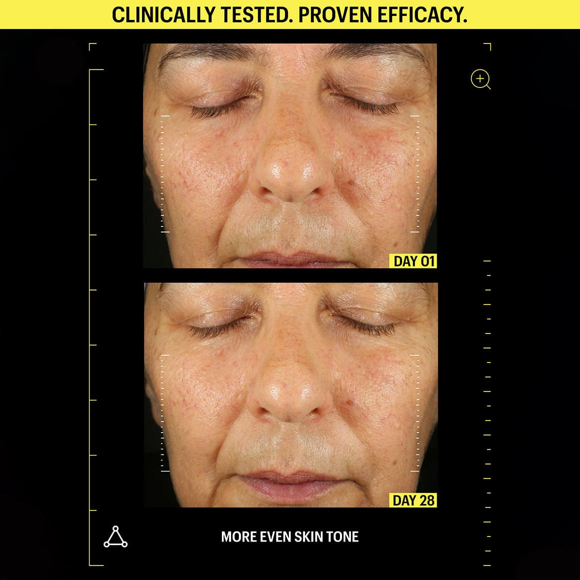 Before and after comparison of skin tone improvement with clinical testing results.