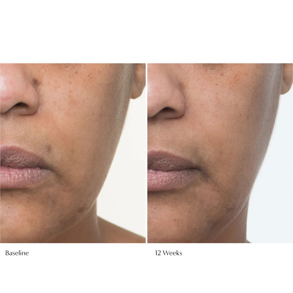 Le Prunier Plumscreen results before and after 12 weeks.
