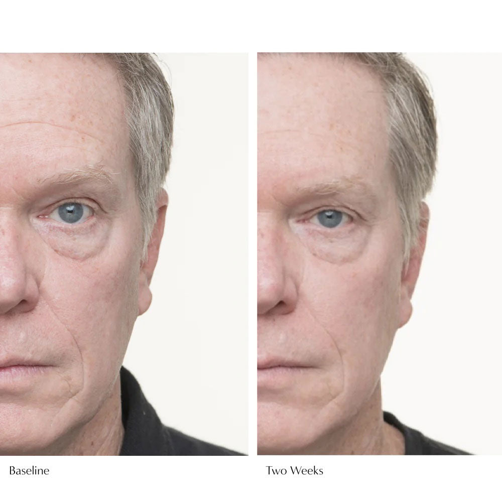 Le Prunier Plumscreen before and after two weeks of use . 