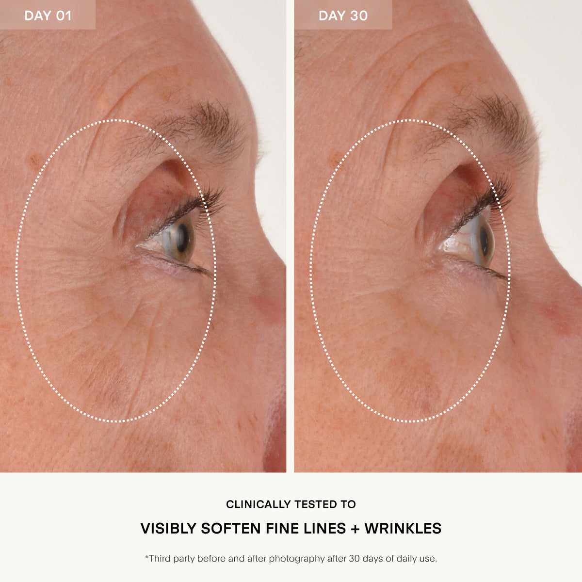 Before and after comparison of eye area with visible fine lines and wrinkles on Day 01 and Day 30.