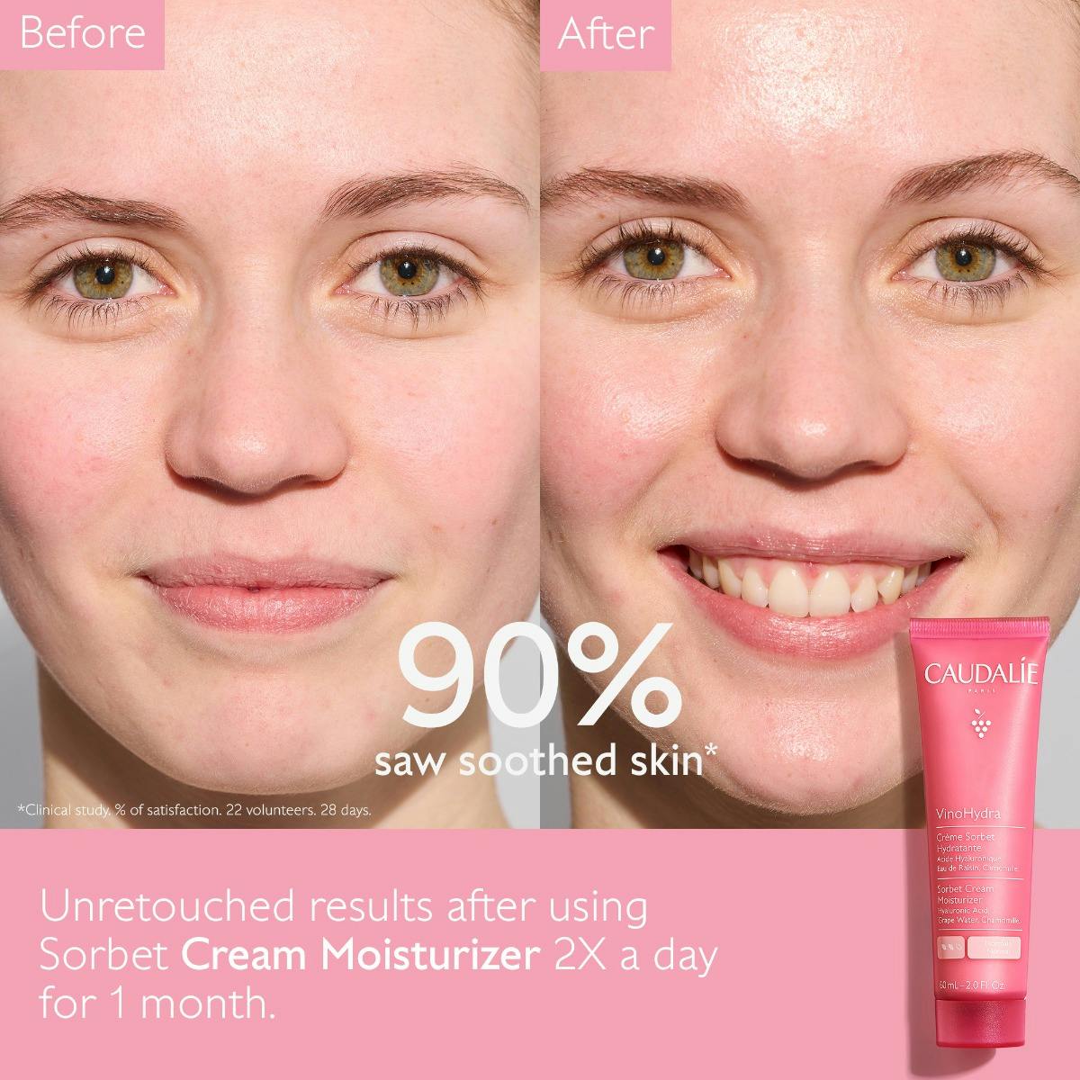 VinoHydra Sorbet Cream Moisturizer