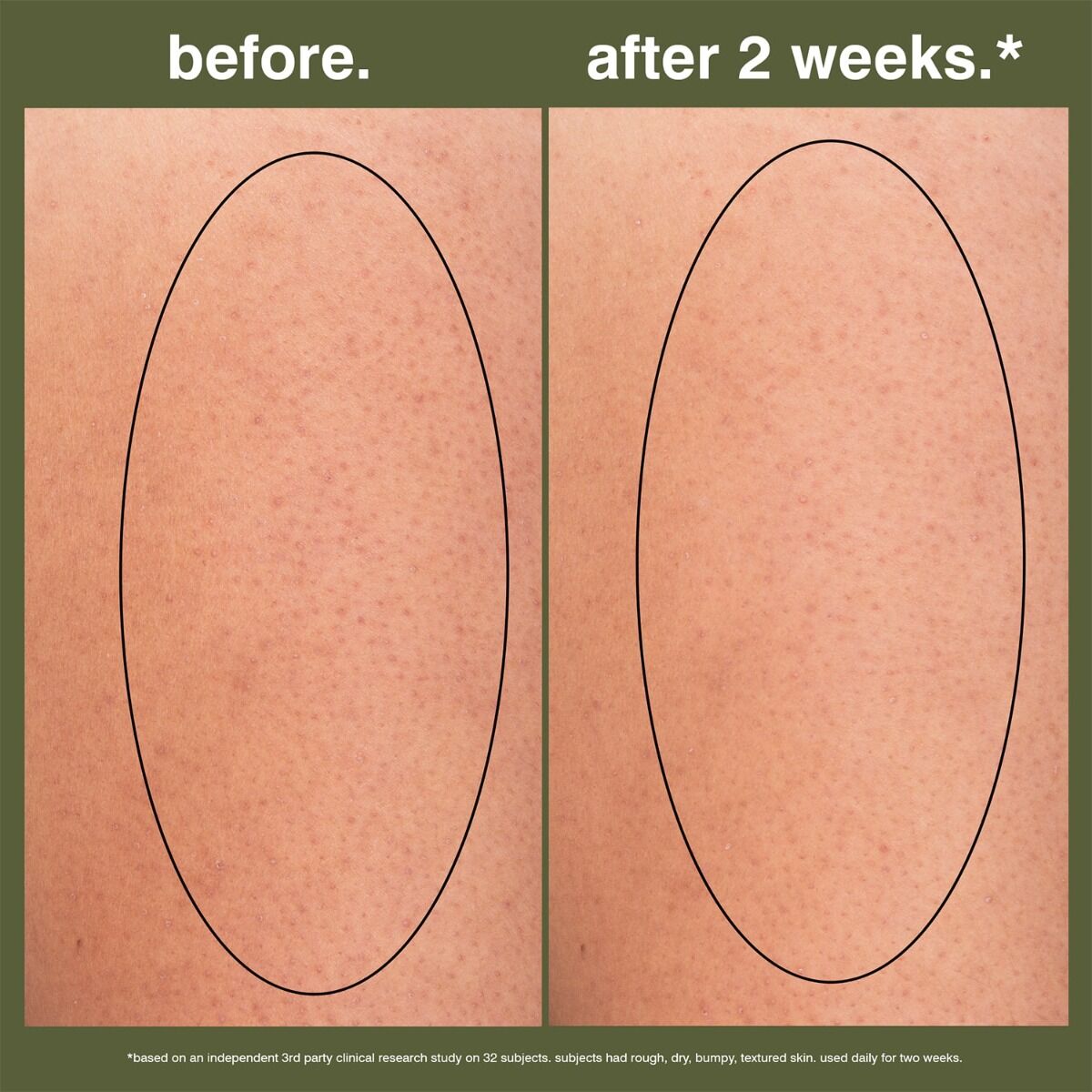 Skin showing clinical research study results of Malin + Goetz Eucalyptus Smoothing Body Gel 