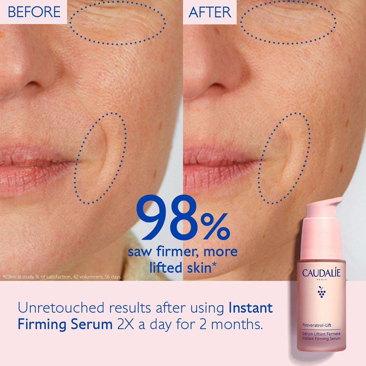 Closeup of a woman's face before and after using Caudalie Resveratrol-Lift Serum.